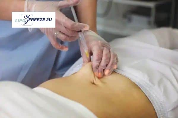 How Does Aqualyx Fat Dissolving Injection Work to Break Down Fat Essex?