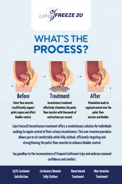 Diagram of how incontinence treatment Essex works.