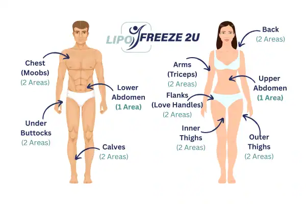 Areas you can have fat freezing treatment Essex