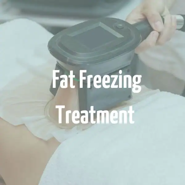 fat freezing treatment Essex