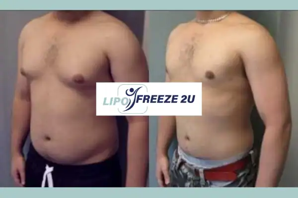 How Long Does It Take to See Results Essex?