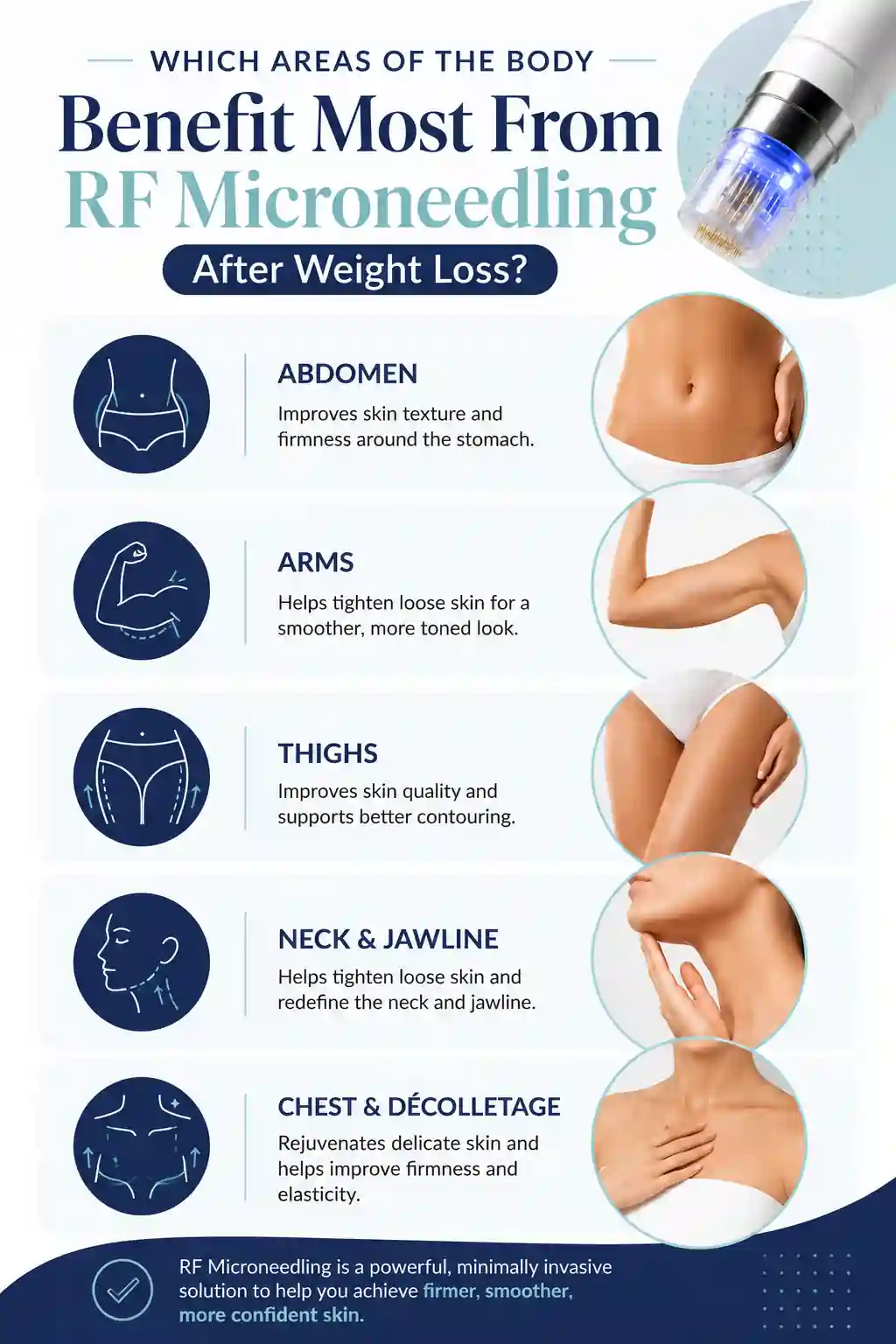Which Areas of the Body Benefit Most From RF Microneedling After Weight Loss Essex
